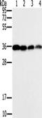 Centromere Protein V antibody, TA351558, Origene, Western Blot image 