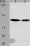 ADAM Metallopeptidase Domain 11 antibody, TA323015, Origene, Western Blot image 