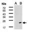 DnaJ Heat Shock Protein Family (Hsp40) Member B9 antibody, NBP2-17246, Novus Biologicals, Western Blot image 