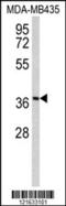 Limbic System Associated Membrane Protein antibody, LS-C165902, Lifespan Biosciences, Western Blot image 