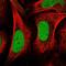 Centromere protein Q antibody, NBP2-58183, Novus Biologicals, Immunofluorescence image 