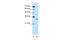 SBDS Ribosome Maturation Factor antibody, ARP45719_T100, Aviva Systems Biology, Western Blot image 