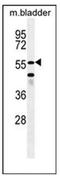 SHQ1, H/ACA Ribonucleoprotein Assembly Factor antibody, AP53912PU-N, Origene, Western Blot image 
