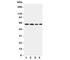 Lecithin-Cholesterol Acyltransferase antibody, R31073, NSJ Bioreagents, Western Blot image 