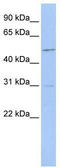 Scianna blood group antigen antibody, TA344158, Origene, Western Blot image 