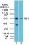 Receptor-interacting serine/threonine-protein kinase 1 antibody, NBP2-24739, Novus Biologicals, Western Blot image 