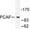Lysine Acetyltransferase 2B antibody, AP06405PU-N, Origene, Western Blot image 