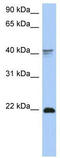 Homeobox protein DLX-4 antibody, TA335208, Origene, Western Blot image 