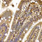 Cytoplasmic Linker Associated Protein 1 antibody, A7081, ABclonal Technology, Immunohistochemistry paraffin image 
