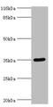 Sulfotransferase Family 1B Member 1 antibody, A50508-100, Epigentek, Western Blot image 