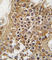 ALK Receptor Tyrosine Kinase antibody, abx033503, Abbexa, Western Blot image 