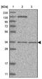 Nectin Cell Adhesion Molecule 1 antibody, NBP1-86554, Novus Biologicals, Western Blot image 