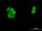 Progesterone Receptor antibody, H00005241-M01, Novus Biologicals, Immunocytochemistry image 