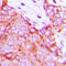 Ephrin A5 antibody, GTX56095, GeneTex, Immunohistochemistry paraffin image 