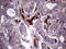 Mitogen-Activated Protein Kinase 8 Interacting Protein 1 antibody, M05068, Boster Biological Technology, Immunohistochemistry paraffin image 