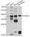 Protein Kinase AMP-Activated Non-Catalytic Subunit Beta 1 antibody, A7921, ABclonal Technology, Western Blot image 