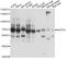 NOP58 Ribonucleoprotein antibody, A14129, ABclonal Technology, Western Blot image 