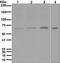 ATP Binding Cassette Subfamily D Member 3 antibody, TA310768, Origene, Western Blot image 