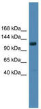 Diacylglycerol Kinase Theta antibody, TA340014, Origene, Western Blot image 