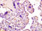 Luteinizing Hormone/Choriogonadotropin Receptor antibody, GTX60163, GeneTex, Immunohistochemistry paraffin image 