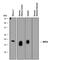 NPC Intracellular Cholesterol Transporter 2 antibody, AF8644, R&D Systems, Western Blot image 