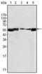 LYN Proto-Oncogene, Src Family Tyrosine Kinase antibody, AM06164SU-N, Origene, Western Blot image 