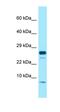 HCG IX antibody, orb326527, Biorbyt, Western Blot image 