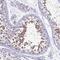Tripartite Motif Containing 37 antibody, HPA021911, Atlas Antibodies, Immunohistochemistry frozen image 