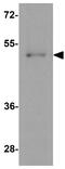 Spermatogenesis Associated 6 antibody, GTX31461, GeneTex, Western Blot image 