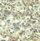 Akt antibody, AP0275, ABclonal Technology, Immunohistochemistry paraffin image 