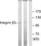 Integrin beta-3 antibody, TA313365, Origene, Western Blot image 
