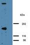 AHNAK Nucleoprotein antibody, ab68556, Abcam, Western Blot image 