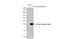 HA tag antibody, GTX115044, GeneTex, Western Blot image 