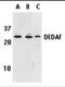 RING1 And YY1 Binding Protein antibody, 2227, ProSci Inc, Western Blot image 