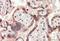 Teratocarcinoma-derived growth factor antibody, orb20444, Biorbyt, Immunohistochemistry paraffin image 