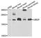 Ubiquitin Conjugating Enzyme E2 F (Putative) antibody, orb373279, Biorbyt, Western Blot image 