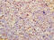 Cyclic AMP-dependent transcription factor ATF-3 antibody, GTX02578, GeneTex, Immunohistochemistry paraffin image 