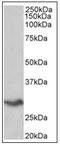 V-Set Domain Containing T Cell Activation Inhibitor 1 antibody, AP31843PU-N, Origene, Western Blot image 