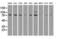 B-Raf Proto-Oncogene, Serine/Threonine Kinase antibody, LS-C114543, Lifespan Biosciences, Western Blot image 
