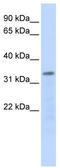 RNA Polymerase III Subunit F antibody, TA346754, Origene, Western Blot image 