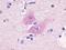Endothelin B receptor-like protein 2 antibody, orb84894, Biorbyt, Immunohistochemistry paraffin image 