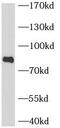 BCL6 Transcription Repressor antibody, FNab00849, FineTest, Western Blot image 