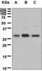 Inhibitor Of Growth Family Member 4 antibody, GTX62655, GeneTex, Western Blot image 