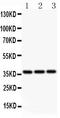 BMI1 Proto-Oncogene, Polycomb Ring Finger antibody, LS-C343996, Lifespan Biosciences, Western Blot image 