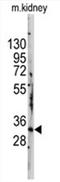 Signal Transducing Adaptor Family Member 1 antibody, AP11474PU-N, Origene, Western Blot image 
