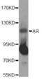 Androgen Receptor antibody, FNab00388, FineTest, Western Blot image 