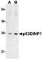 Tumor Protein P53 Inducible Nuclear Protein 1 antibody, ADI-905-300-100, Enzo Life Sciences, Western Blot image 