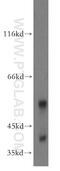 CD72 Molecule antibody, 13469-1-AP, Proteintech Group, Western Blot image 