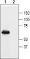Prokineticin Receptor 1 antibody, TA329007, Origene, Western Blot image 