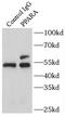 Peroxisome proliferator-activated receptor alpha antibody, FNab06663, FineTest, Immunoprecipitation image 